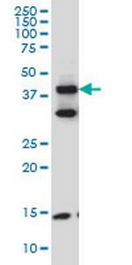 FBLIM1 Antibody in Western Blot (WB)