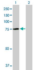 AHI1 Antibody in Western Blot (WB)