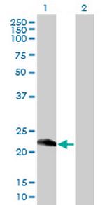 RETSAT Antibody in Western Blot (WB)