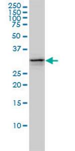 UBE2R2 Antibody in Western Blot (WB)