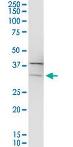 PIH1D1 Antibody in Western Blot (WB)