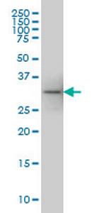 FLJ20643 Antibody in Western Blot (WB)