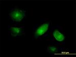 VAC14 Antibody in Immunocytochemistry (ICC/IF)