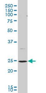 BCAP29 Antibody in Western Blot (WB)