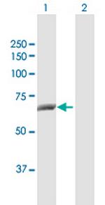 CTPS2 Antibody in Western Blot (WB)