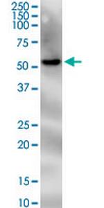 PNPLA2 Antibody in Western Blot (WB)