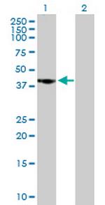 CAMK1D Antibody in Western Blot (WB)