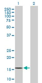 IL21 Antibody in Western Blot (WB)