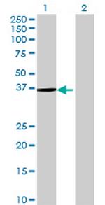 SRR Antibody in Western Blot (WB)