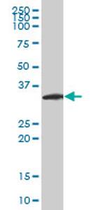 NEUROG2 Antibody in Western Blot (WB)