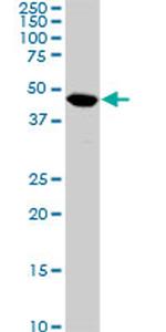 C17ORF75 Antibody in Western Blot (WB)