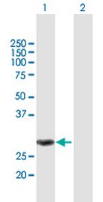 MMS19 Antibody in Western Blot (WB)