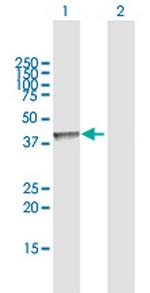 AACS Antibody in Western Blot (WB)