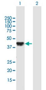 DLK2 Antibody in Western Blot (WB)