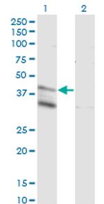 LASS4 Antibody in Western Blot (WB)