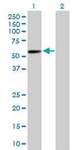 GAL3ST4 Antibody in Western Blot (WB)