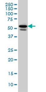 TBL1XR1 Antibody in Western Blot (WB)