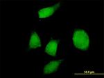 PHF17 Antibody in Immunocytochemistry (ICC/IF)