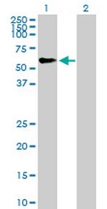 TRIM46 Antibody in Western Blot (WB)