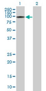 ITPKC Antibody in Western Blot (WB)