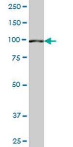 SETDB2 Antibody in Western Blot (WB)