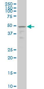TSSK1B Antibody in Western Blot (WB)