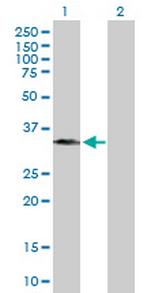 BXDC1 Antibody in Western Blot (WB)