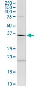 HAGHL Antibody in Western Blot (WB)