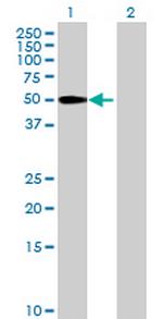 MGC4618 Antibody in Western Blot (WB)
