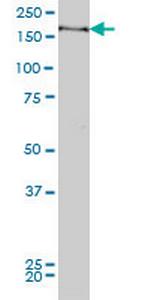 MYPN Antibody in Western Blot (WB)