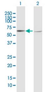 CNDP1 Antibody in Western Blot (WB)