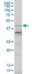 LHX4 Antibody in Western Blot (WB)