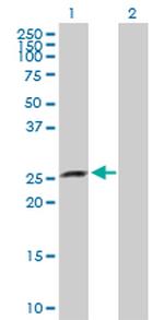 XRCC6BP1 Antibody in Western Blot (WB)