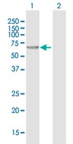 CHMP7 Antibody in Western Blot (WB)