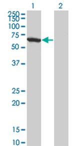 WDR20 Antibody in Western Blot (WB)