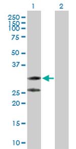 C1QTNF2 Antibody in Western Blot (WB)