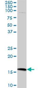 CMTM5 Antibody in Western Blot (WB)