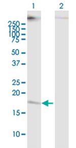 CMTM5 Antibody in Western Blot (WB)