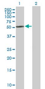 CYP2R1 Antibody in Western Blot (WB)