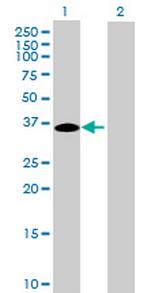 MGC33367 Antibody in Western Blot (WB)