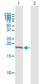 TBN Antibody in Western Blot (WB)