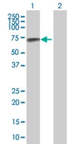 GRK7 Antibody in Western Blot (WB)