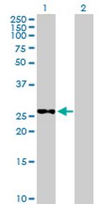 METTL6 Antibody in Western Blot (WB)