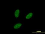 IRAK1BP1 Antibody in Immunocytochemistry (ICC/IF)