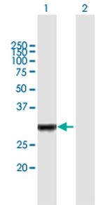 IRAK1BP1 Antibody in Western Blot (WB)