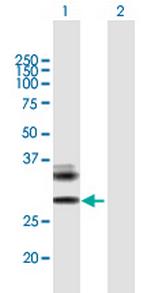 RAET1E Antibody in Western Blot (WB)