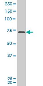 PASD1 Antibody in Western Blot (WB)