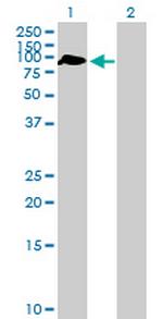 ZBTB46 Antibody in Western Blot (WB)