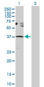 SESN3 Antibody in Western Blot (WB)