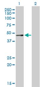 SERPINA12 Antibody in Western Blot (WB)